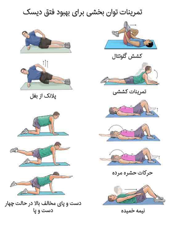 ورزش برای دیسک کمر