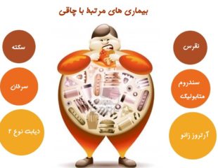 بیماری های مرتبط با چاقی