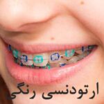 ارتودنسی رنگی