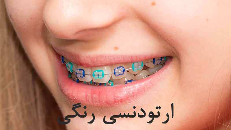 ارتودنسی رنگی
