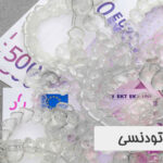هزینه ارتودنسی 1402 در ایران