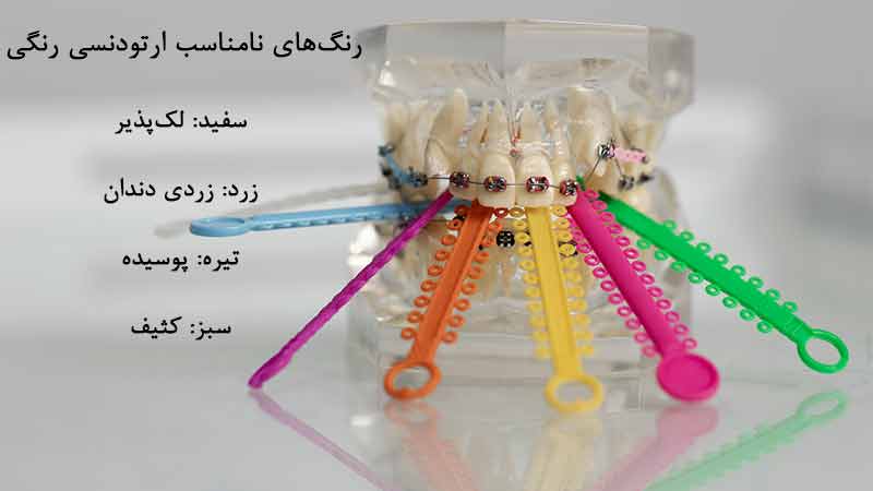 چه رنگ هایی را انتخاب نکنیم؟
