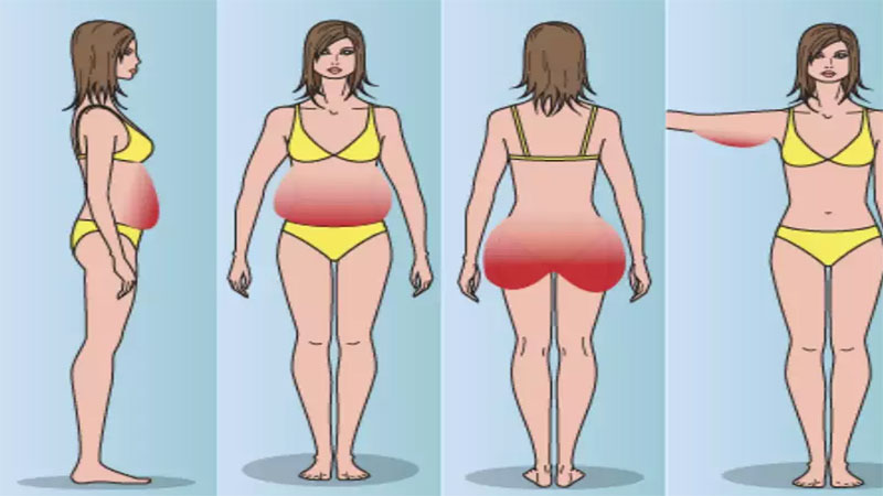 علل هورمونی چاقی