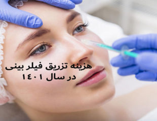 هزینه فیلر بینی