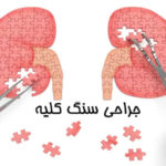 جراحی سنگ کلیه