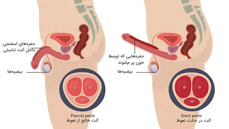  اختلال در نعوظ