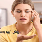 ریزش ابرو بعد از کاشت