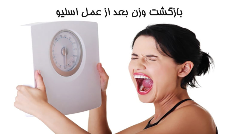 بازگشت وزن بعد از عمل اسلیو