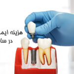 هزینه ایمپلنت دندان