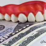 هزینه جرم گیری دندان