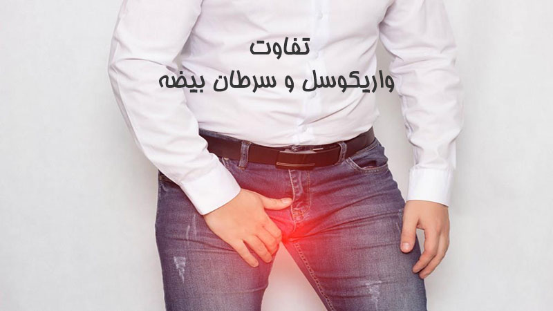 تفاوت واریکوسل و سرطان بیضه