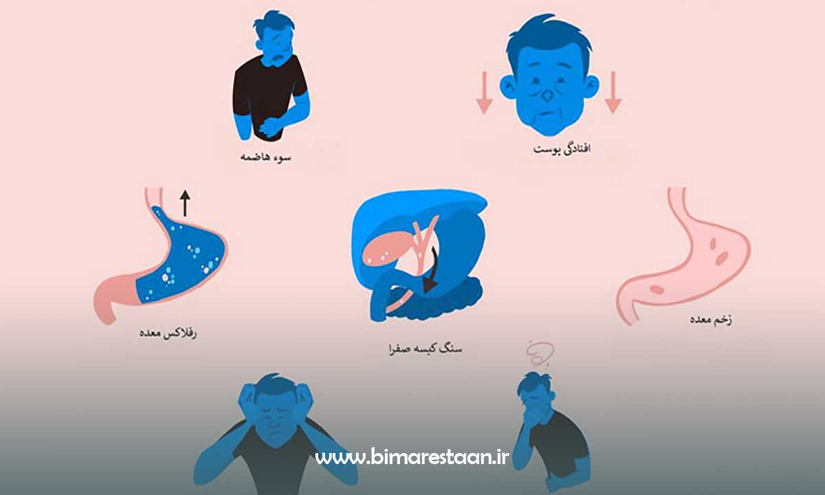 عوارض اسلیو معده