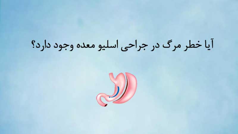 آیا خطر مرگ در جراحی اسلیو معده وجود دارد؟