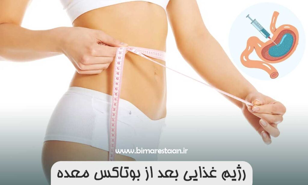 رژیم غذایی بعد از بوتاکس معده