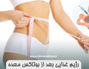 رژیم غذایی بعد از بوتاکس معده 