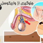 Prevention of varicocele
