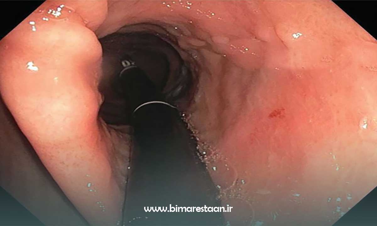 چگونه می توان خطرات را به حداقل رساند؟