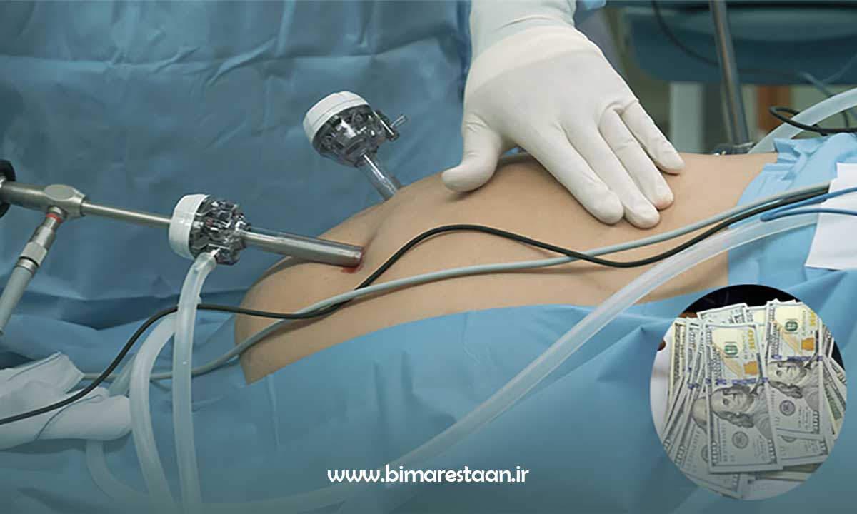 هزینه های عمل جراحی اسلیو معده
