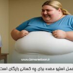 عمل اسلیو معده برای چه کسانی رایگان است؟ عمل اسلیو معده برای چه کسانی رایگان است؟