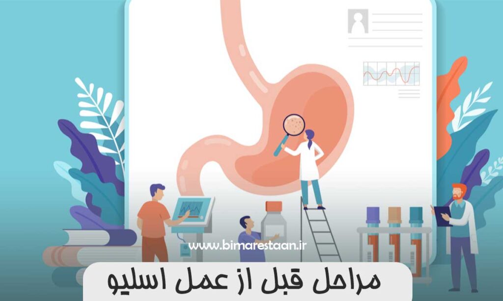 مراحل قبل از عمل اسلیو