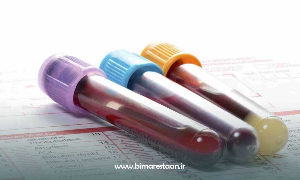 انجام آزمایش های لازم