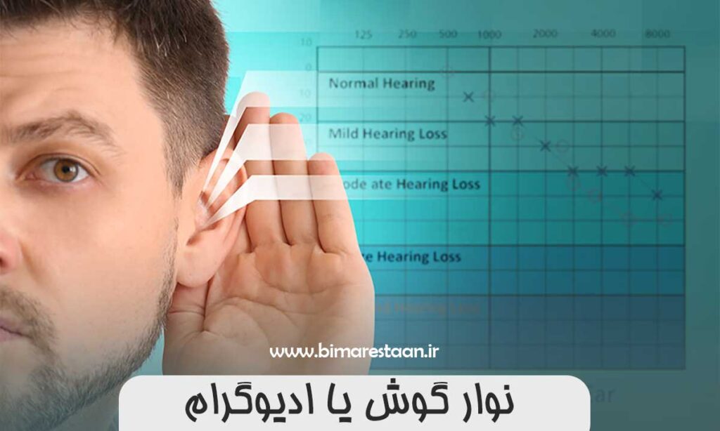 نوار گوش یا ادیوگرام