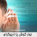 نوار گوش یا ادیوگرام