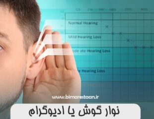 نوار گوش یا ادیوگرام