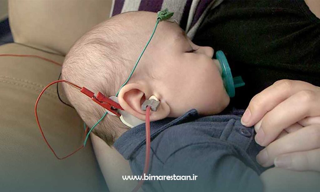 نوار گوش در کودکان و نوزادان