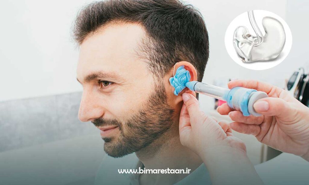 مناسب‌ ترین قالب و تکنولوژی برای سمعک‌