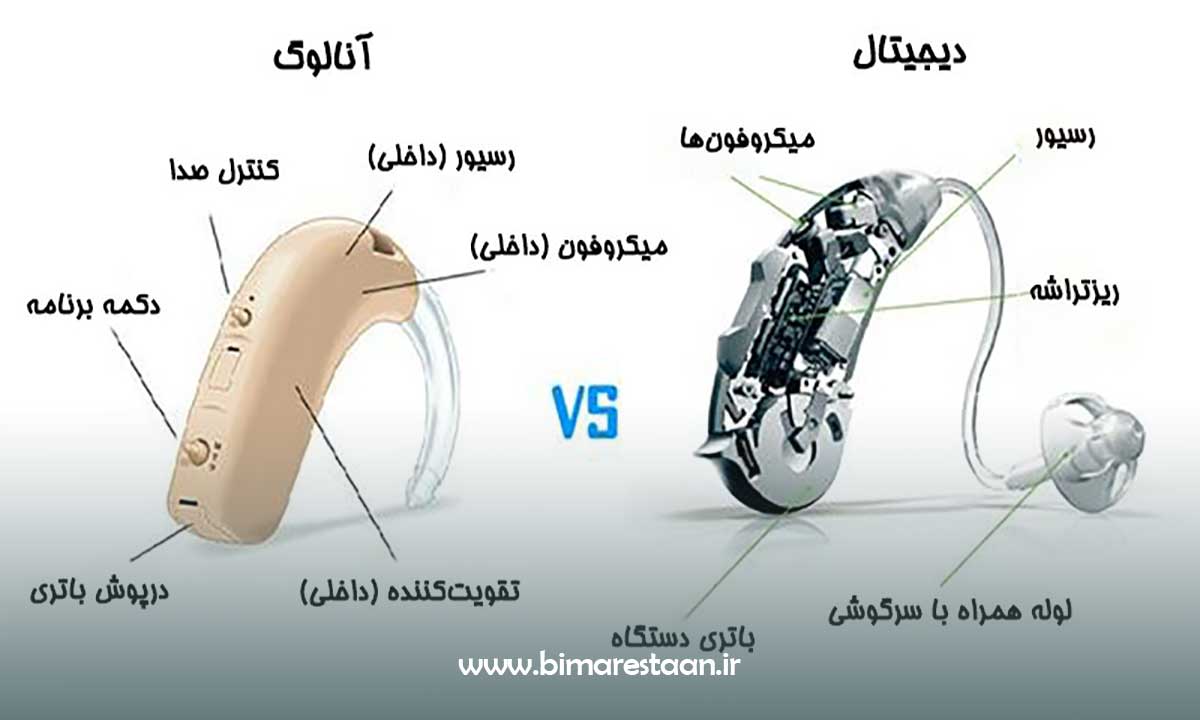 سمعک دیجیتال و آنالوگ