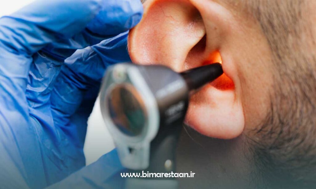 تشخیص سکته گوش