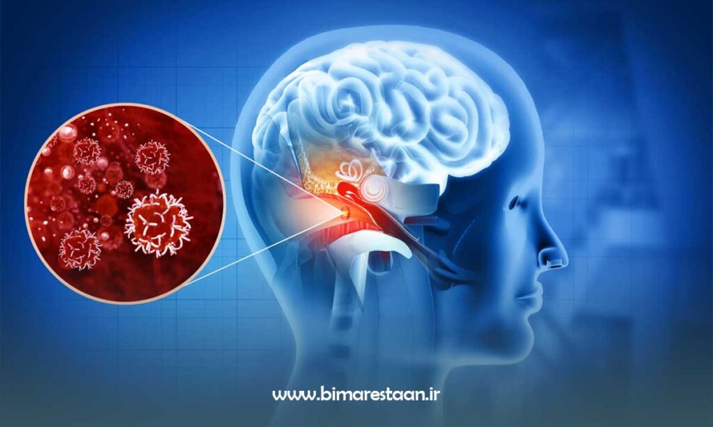 کدام افراد بیشتر در خطر کری ناگهانی هستند؟
