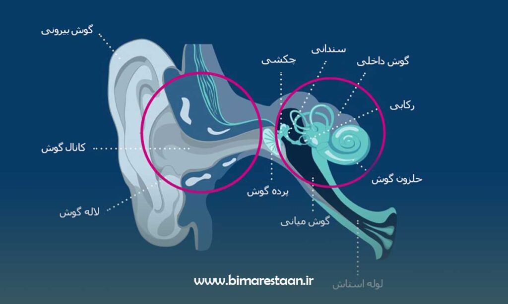 کم شنوایی مختلط