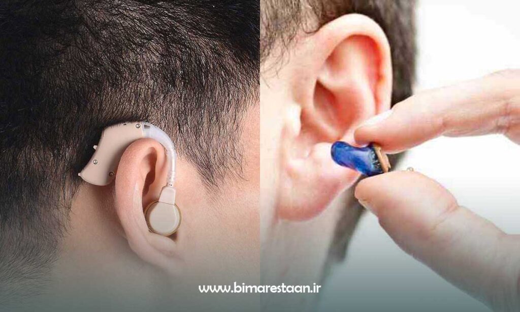 تفاوت قیمت سمعک دولتی با سمعک آزاد