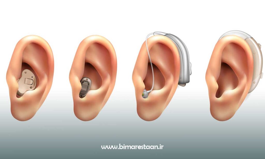 انواع سمعک موجود در بازار