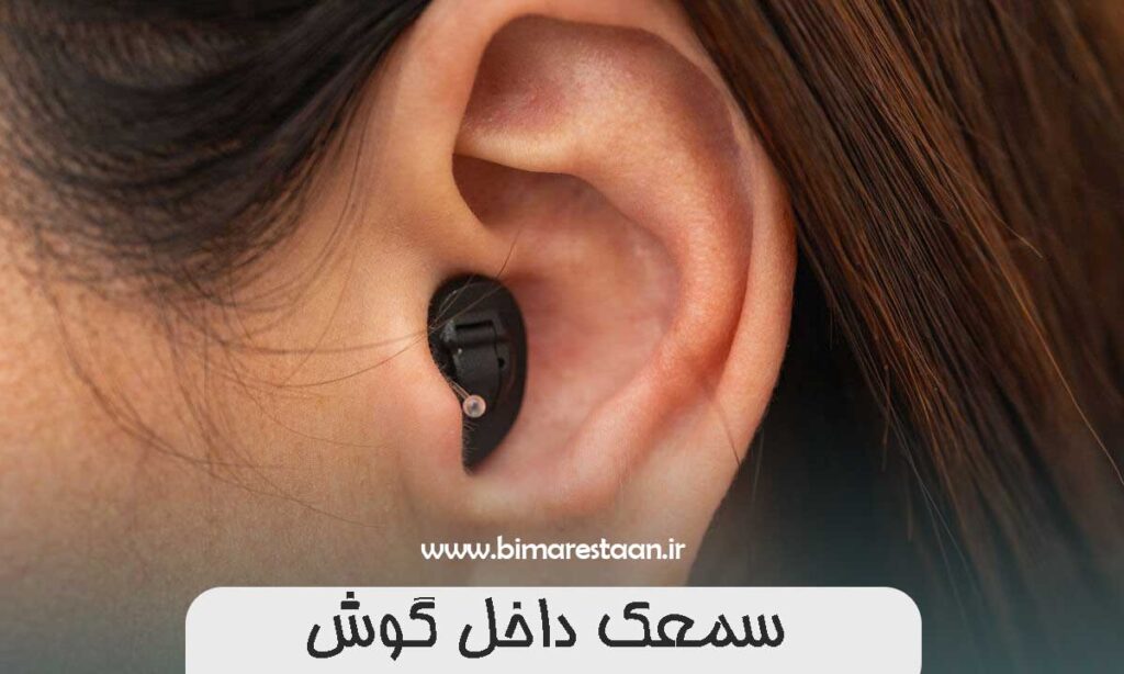 سمعک داخل گوش