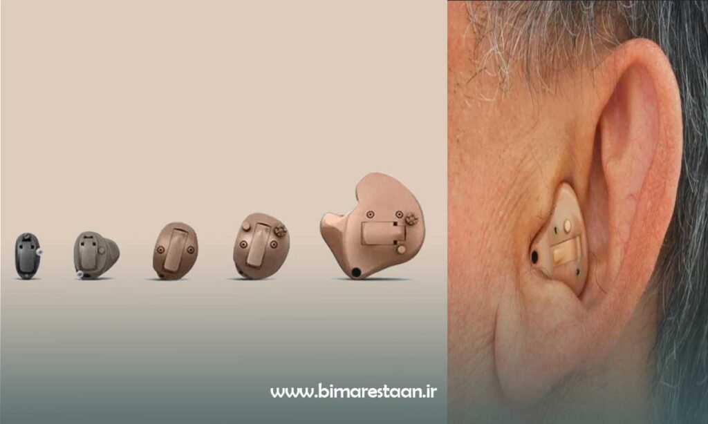 انواع سمعک داخل گوش
